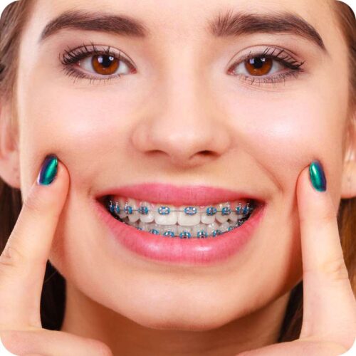 Garota com aparelho ortodontico