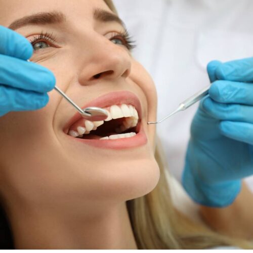 dentista limpeza e restauração